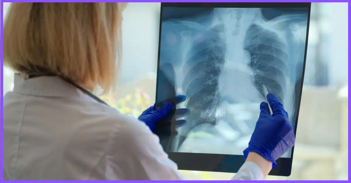 A woman with gray hair and an off-white shirt examining an asthma patient's x-ray