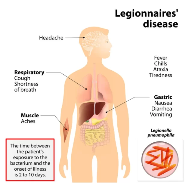 An infographic about Legionnaires’ disease, a type of pneumonia caused by Legionella bacteria. The infographic shows how the bacteria can infect different parts of the human body, such as the lungs, heart, brain, and kidneys.