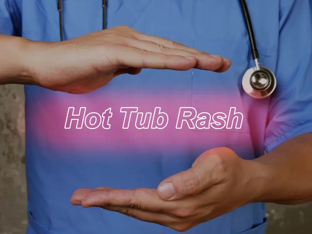 A doctor with a blue shirt showing eczema from hot tub text