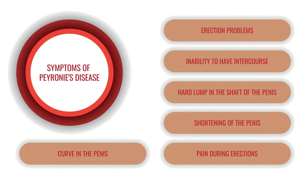 A text infographic for Castor Oil Massage for Peyronie's Disease